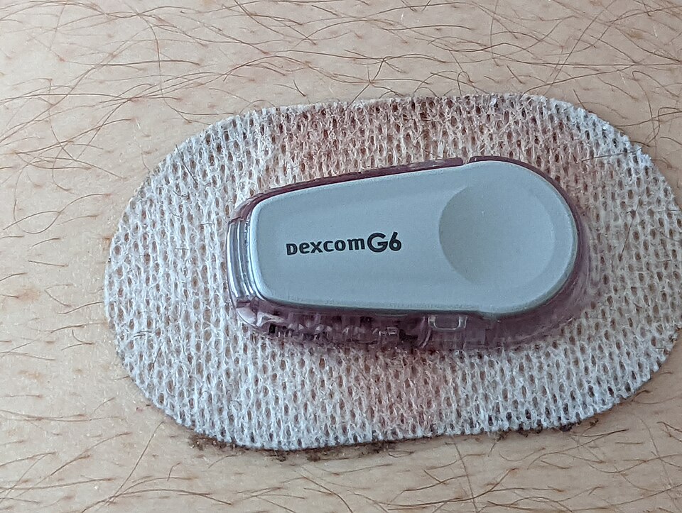 Dexcom Dexcom G6